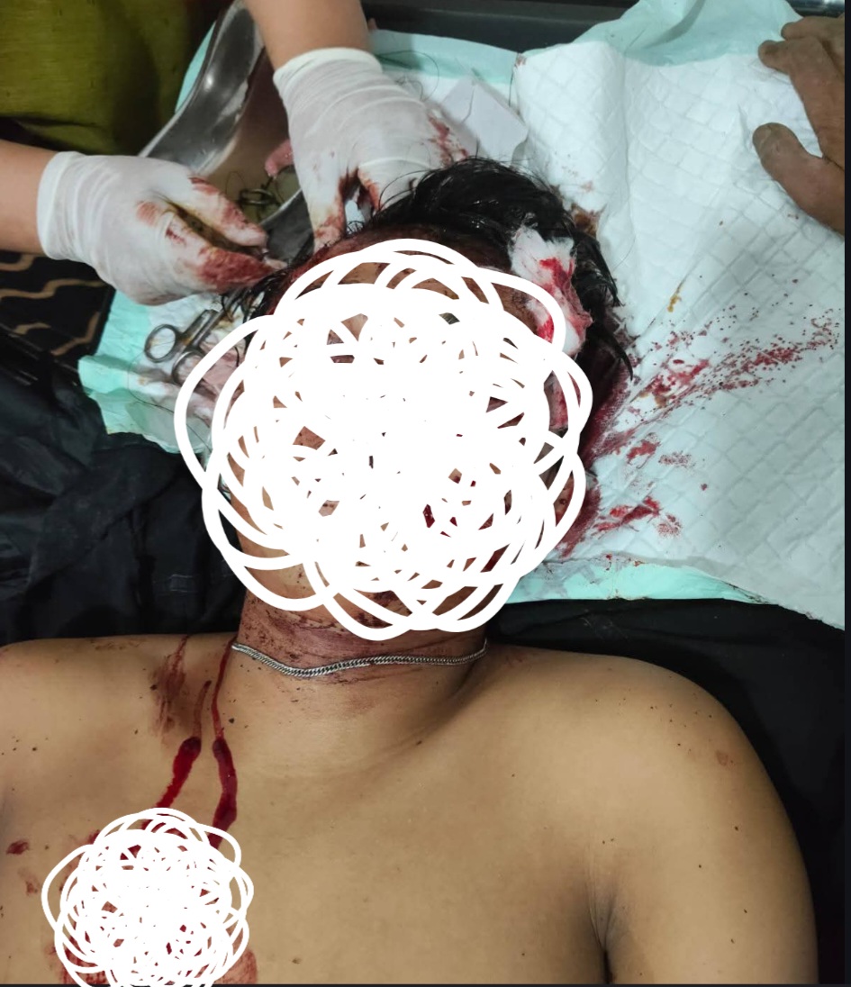 Pria Misterius Alami Kecelakaan di Warkuk Ranau Selatan, Dilarikan ke Puskesmas