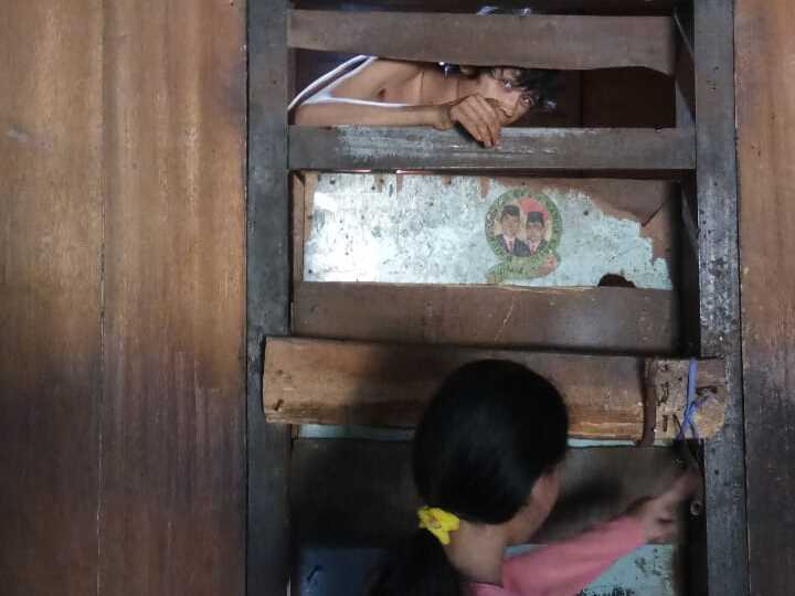 Mirisnya Yogi Sastra, 16 Tahun Sakit Tak Miliki Biaya Berobat