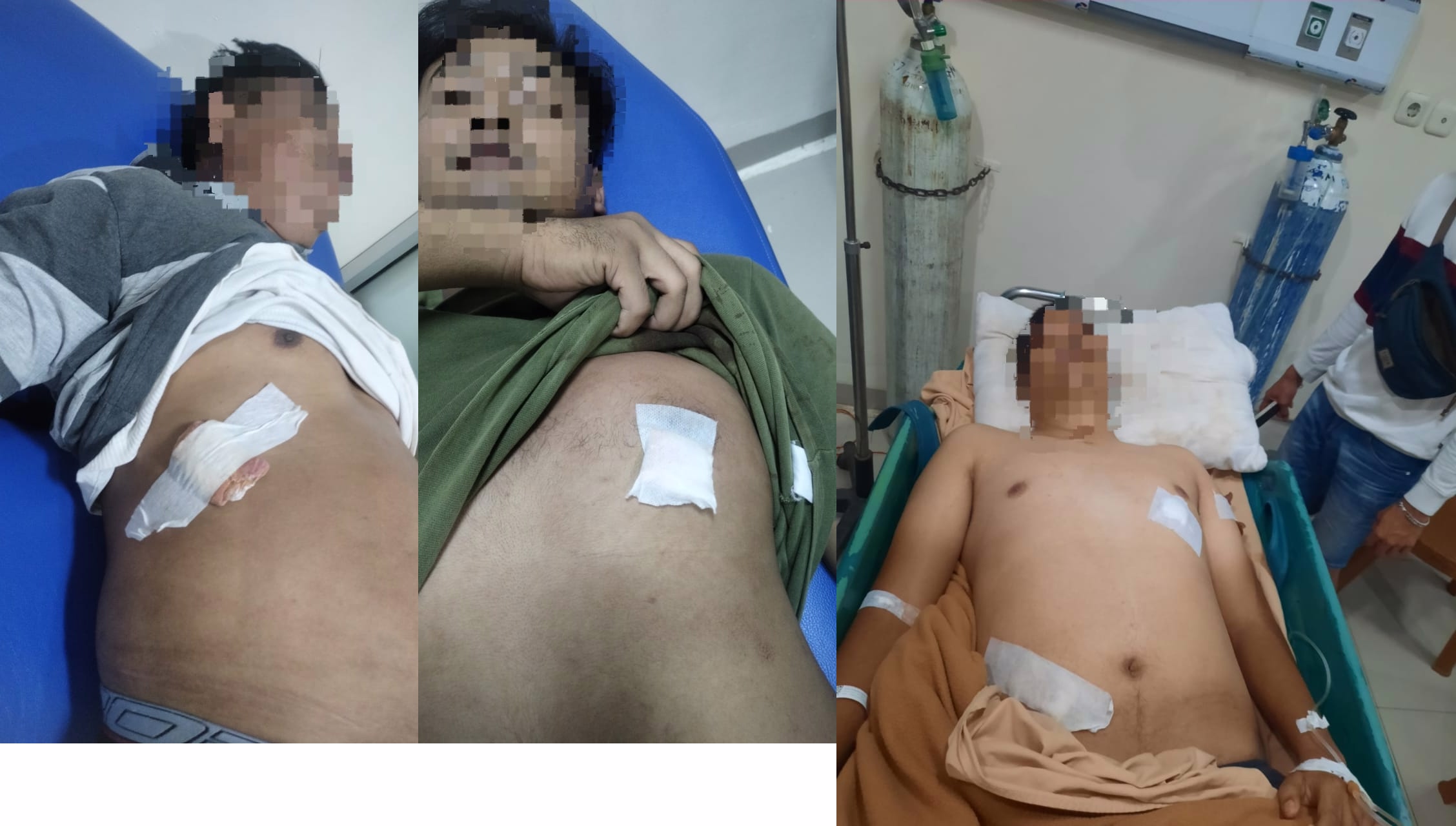 Bandar Judi Melarikan Diri, Tiga Anggota Polres Muratara Terluka dalam Penusukan yang Tragis