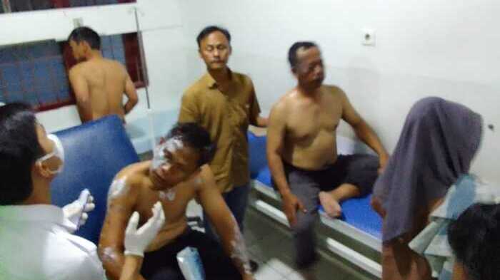  Polisi Kesulitan Buru Pelaku Penyiraman Air Keras