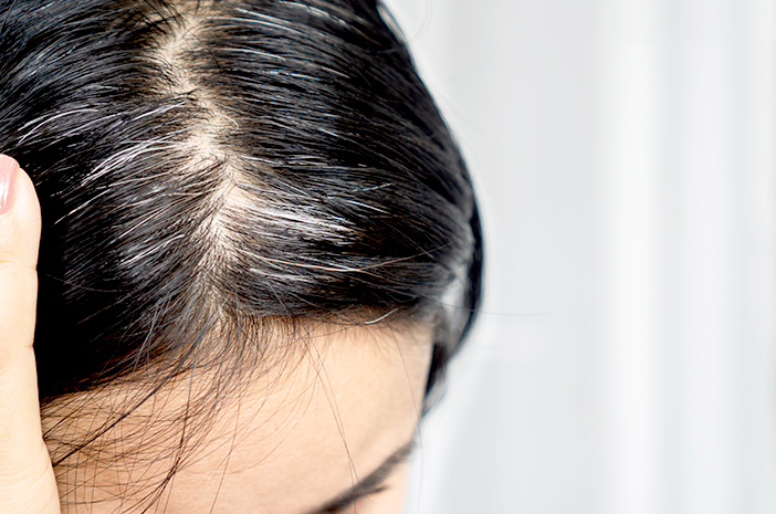 Wah, Ini Tips Mengembalikan Warna Rambut Beruban dengan Bahan Alami dalam 30 Hari