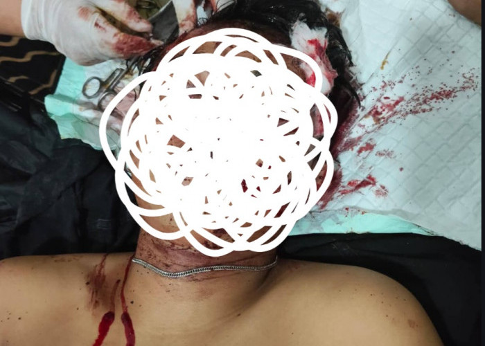 Pria Misterius Alami Kecelakaan di Warkuk Ranau Selatan, Dilarikan ke Puskesmas