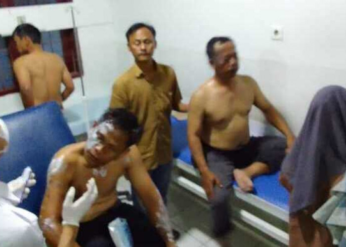  Polisi Kesulitan Buru Pelaku Penyiraman Air Keras