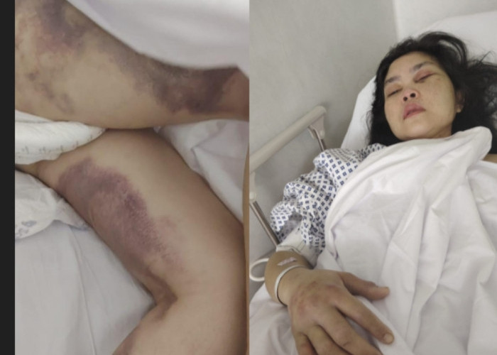 Viral PMI Asal Cianjur Diduga Disiksa Majikan di UEA, Pemerintah Lakukan Penelusuran