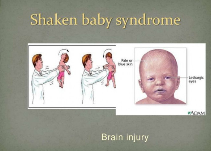 Bayi Mengalami Sindrom Terguncang, Ini yang Harus Diketahui?