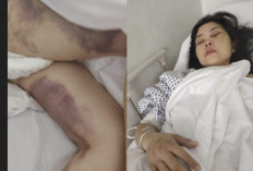 Viral PMI Asal Cianjur Diduga Disiksa Majikan di UEA, Pemerintah Lakukan Penelusuran